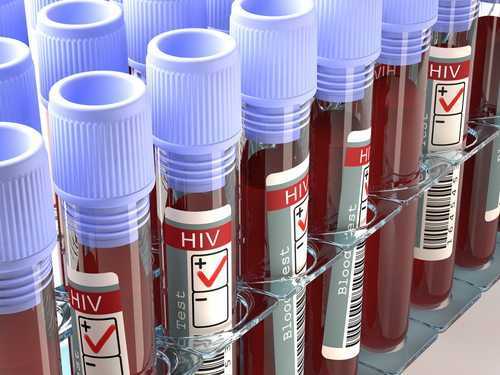 Exército deve aposentar militar com HIV mesmo que não apresente sintomas