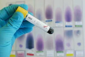 Justiça entende que esconder HIV de companheira em união estável gera dever de indenizar 1 | Juristas TRF3 reintegra portador de HIV a curso de formação de oficiais da aeronáutica