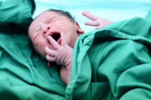 Hospital é condenado por omitir informação sobre fratura em recém-nascido | Juristas