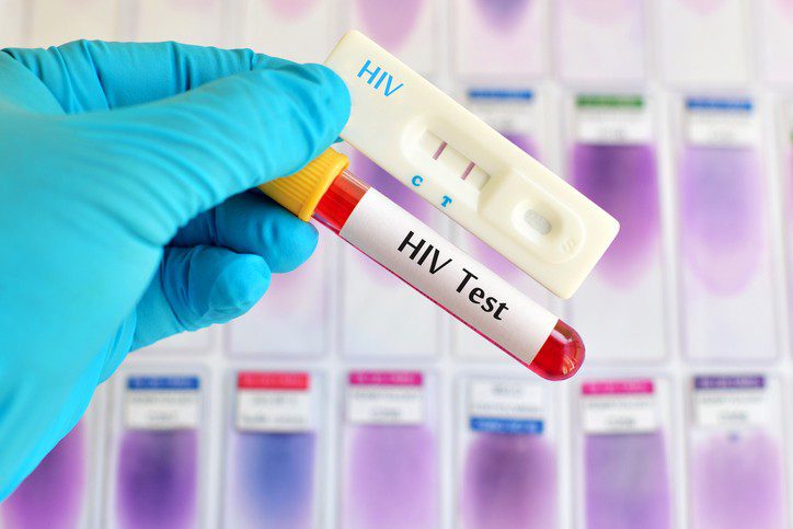 Hemocentro - Vírus HIV - Aids